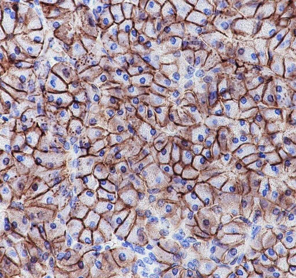 Recombinant ENPP1/PC1 Monoclonal Antibody - small - 2