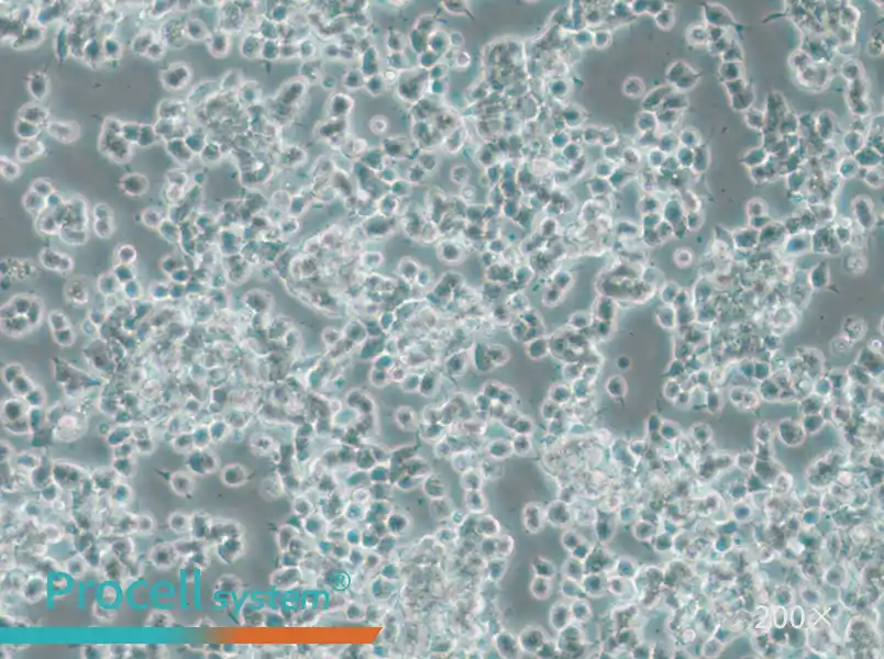 SK-NEP-1 Cell Complete Medium - 5