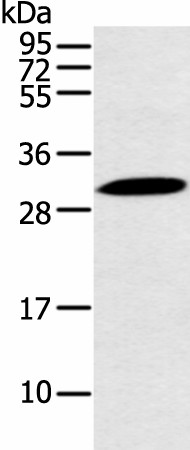 Western blot analysis of Mouse stomach tissue  using YRDC Polyclonal Antibody at dilution of 1:250