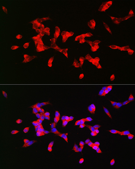 Immunofluorescence analysis of SH-SY5Y cells using CHRM1 Polyclonal Antibody at dilution of 1:200 (40x lens). Blue: DAPI for nuclear staining.