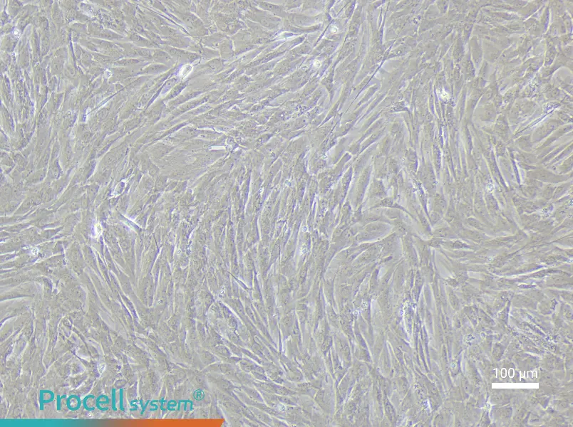 Rat Renal Artery Smooth Muscle Cell Complete Medium - 3