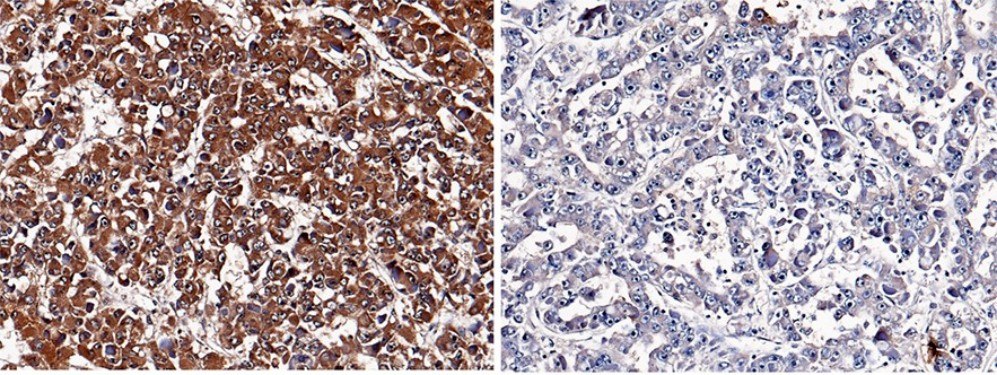 NBL1/DAND1/DAN Monoclonal Antibody - small - 2