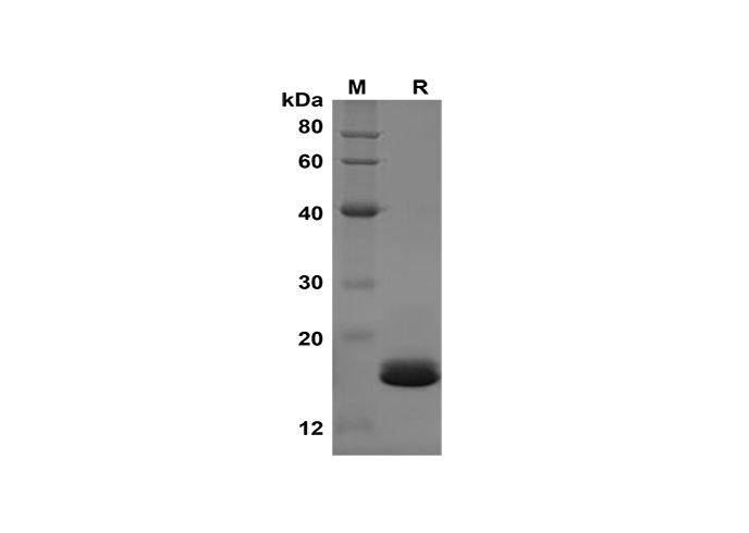 Recombinant Mouse IL-21 Protein(Sumo Tag)-产品推荐-1