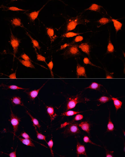 Immunofluorescence analysis of C6 cells using METTL3 Polyclonal Antibody at dilution of  1:100 (40x lens). Blue: DAPI for nuclear staining.