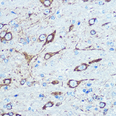 Immunohistochemistry of paraffin-embedded mouse brain using NMDAR1 Polyclonal Antibody at dilution of 100 (40x lens).Perform microwave antigen retrieval with 10 mM PBS buffer pH 7.2 before commencing with IHC staining protocol.