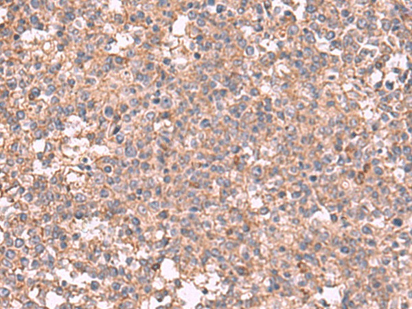 Immunohistochemistry of paraffin-embedded Human tonsil tissue  using MAPK8IP3 Polyclonal Antibody at dilution of 1:45(?200)