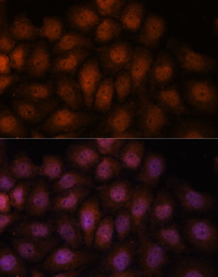 Immunofluorescence analysis of HeLa cells using IPO8 Polyclonal Antibody at dilution of  1:100. Blue: DAPI for nuclear staining.