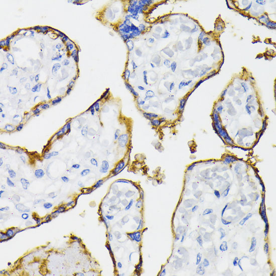 Immunohistochemistry of paraffin-embedded human tonsil using [KO Validated] CD73/NT5E Polyclonal antibody at dilution of 1:50 (40x lens).Perform high press