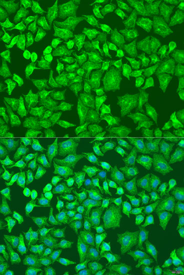 Immunofluorescence analysis of U2OS cells using DVL2 Polyclonal Antibody at dilution of 1:100. Blue: DAPI for nuclear staining.