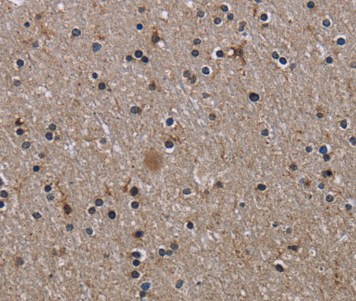 Immunohistochemistry of paraffin-embedded Human brain using ITGB2 Polyclonal Antibody at dilution of 1:50
