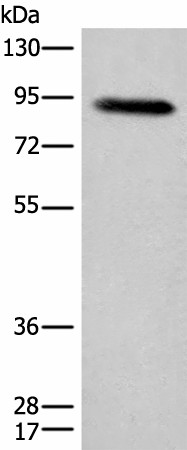 Western blot analysis of Human plasma solution  using C1R Polyclonal Antibody at dilution of 1:800