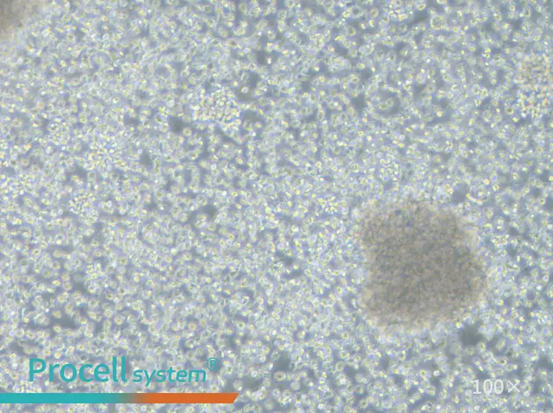 NCI-BL1437 Cell Complete MediumNCI-BL1437 Cell Complete Medium - 3