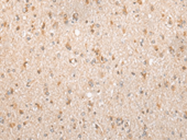 Immunohistochemistry of paraffin-embedded Human brain tissue  using FKBP7 Polyclonal Antibody at dilution of 1:40(?200)