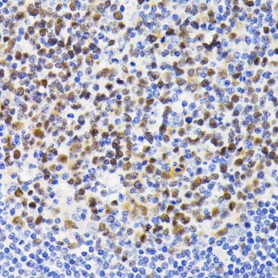 Immunohistochemistry of paraffin-embedded human tonsil using NFAT2 Polyclonal Antibody at dilution of 1:200 (40x lens).Perform microwave antigen retrieval with 10 mM PBS buffer pH 7.2 before commencing with IHC staining protocol.