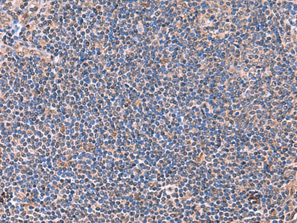 Immunohistochemistry of paraffin-embedded Human tonsil tissue  using PEPD Polyclonal Antibody at dilution of 1:70(?200)