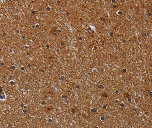 Immunohistochemistry of paraffin-embedded Human brain  using CYP1A2 Polyclonal Antibody at dilution of 1:40