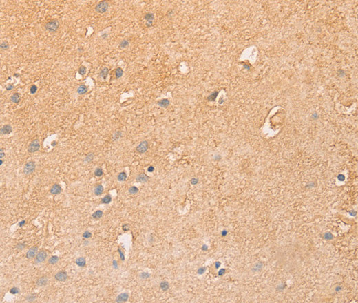 Immunohistochemistry of paraffin-embedded Human brain  using CCL16  Polyclonal Antibody at dilution of 1:50