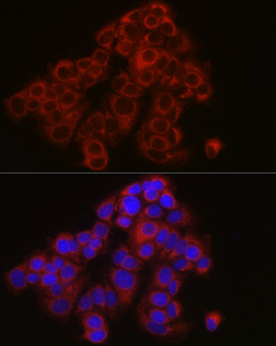 Immunofluorescence analysis of MCF7 cells using TYK2 Polyclonal Antibody at dilution of 1:100 (40x lens). Blue: DAPI for nuclear staining.