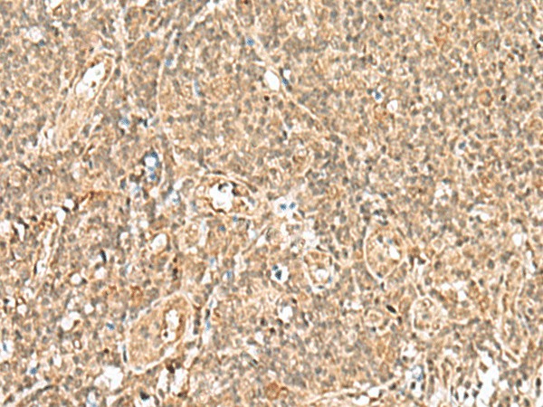 Immunohistochemistry of paraffin-embedded Human tonsil tissue  using GTF2A2 Polyclonal Antibody at dilution of 1:30(?200)