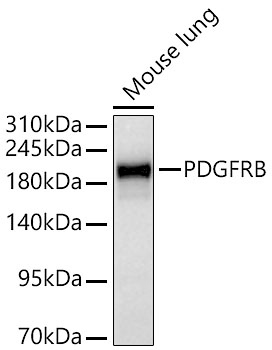 PDGFR beta Polyclonal Antibody - small - 7