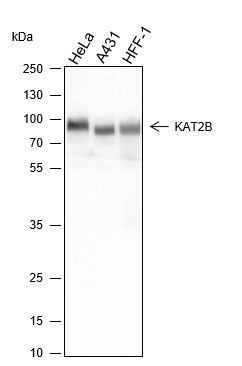 Recombinant PCAF Monoclonal Antibody-searchlist-1