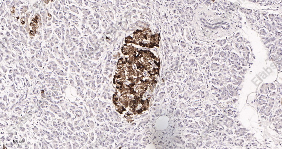Recombinant Chromogranin A Monoclonal Antibody - 2