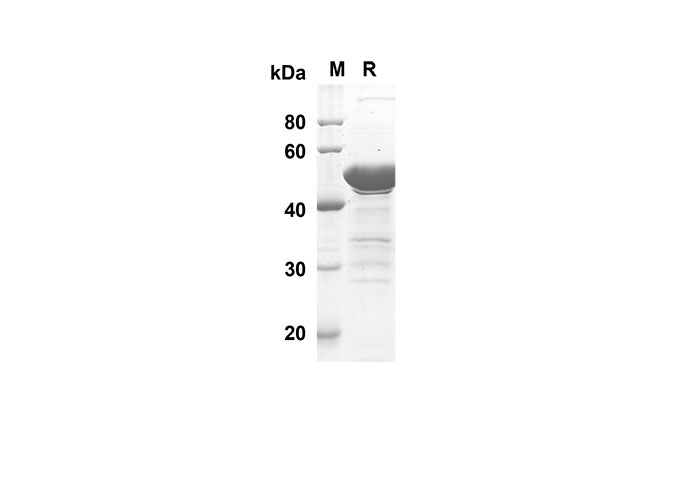 Recombinant Human CDH1 Protein(Trx Tag)-1