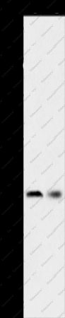 SERPINA5 Polyclonal Antibody - 1