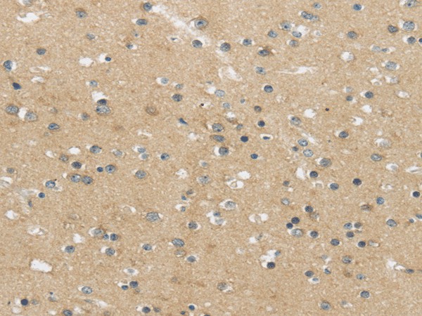 Immunohistochemistry of paraffin-embedded Human brain using MPP6 Polyclonal Antibody at dilution of  1/25