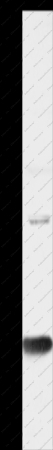 AGR2 Polyclonal Antibody - 1