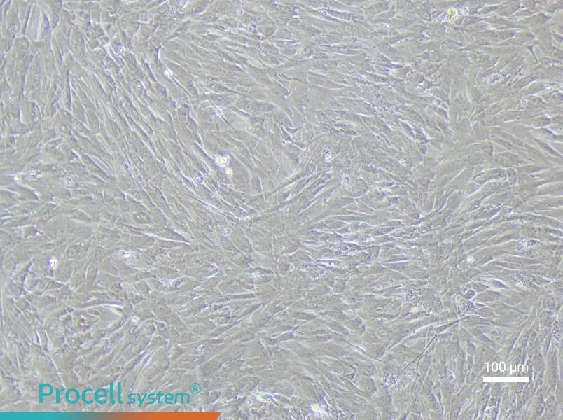 Rat Renal Artery Smooth Muscle Cell Complete Medium - 2