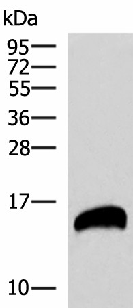 Western blot analysis of Human pancreas tissues lysate  using REG1B Polyclonal Antibody at dilution of 1:800