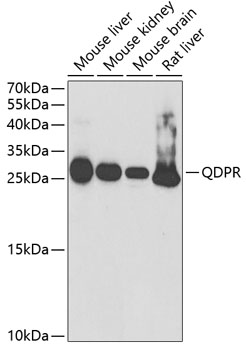 Western blot analysis of extracts of various cell lines using QDPR Polyclonal Antibody at 1:1000 dilution.