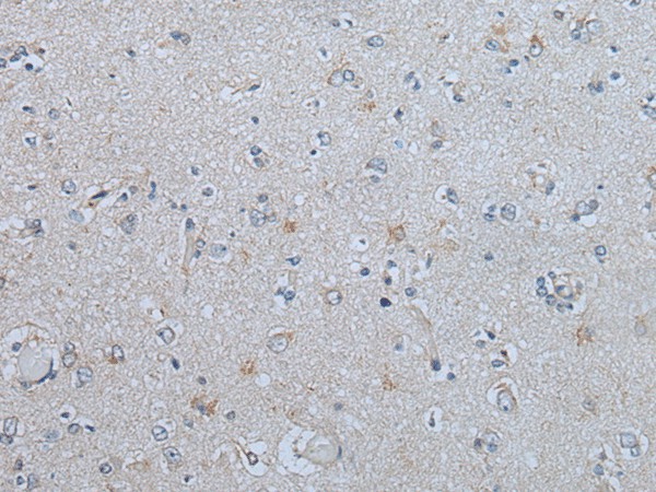 Immunohistochemistry of paraffin-embedded Human brain tissue  using CENPF Polyclonal Antibody at dilution of 1:60(?200)