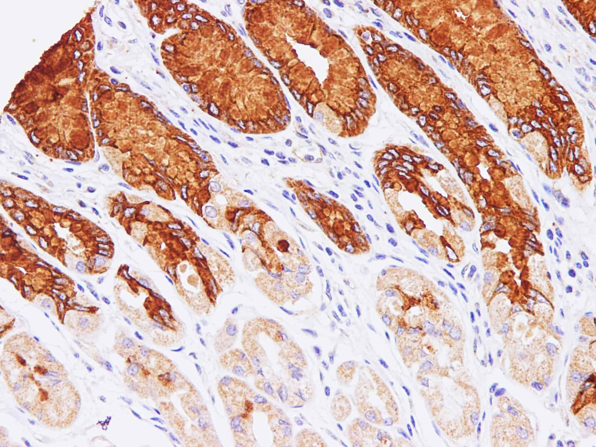 Immunohistochemistry of paraffin-embedded Human stomach using MUC5AC Polyclonal Antibody at dilution of 1:100(400?)