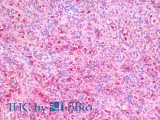 Immunohistochemistry analysis of paraffin-embedded Human Spleen using ITGAX Polyclonal Antibody(Elabscience Product Detected by Lifespan).