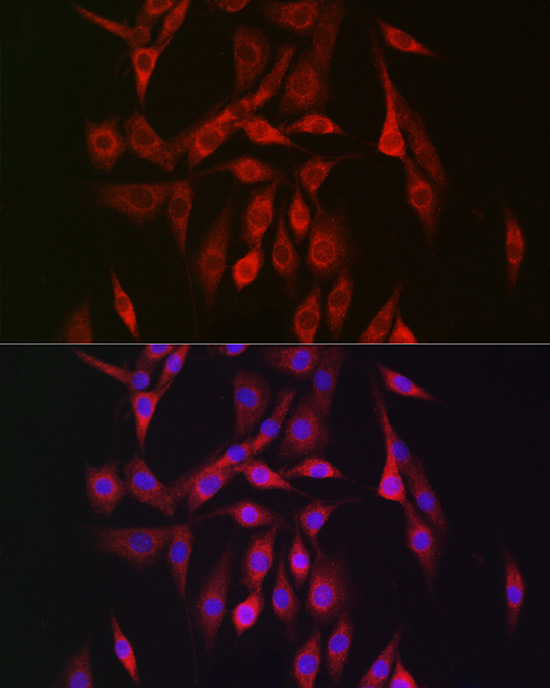 Immunofluorescence analysis of NIH/3T3 cells using PRKAB2 Polyclonal antibody at dilution of 1:150 (40x lens). Blue: DAPI for nuclear staining.