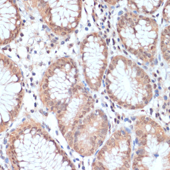 Immunohistochemistry of paraffin-embedded Human stomach using PRMT7 Polyclonal Antibody at dilution of  1:200 (40x lens).