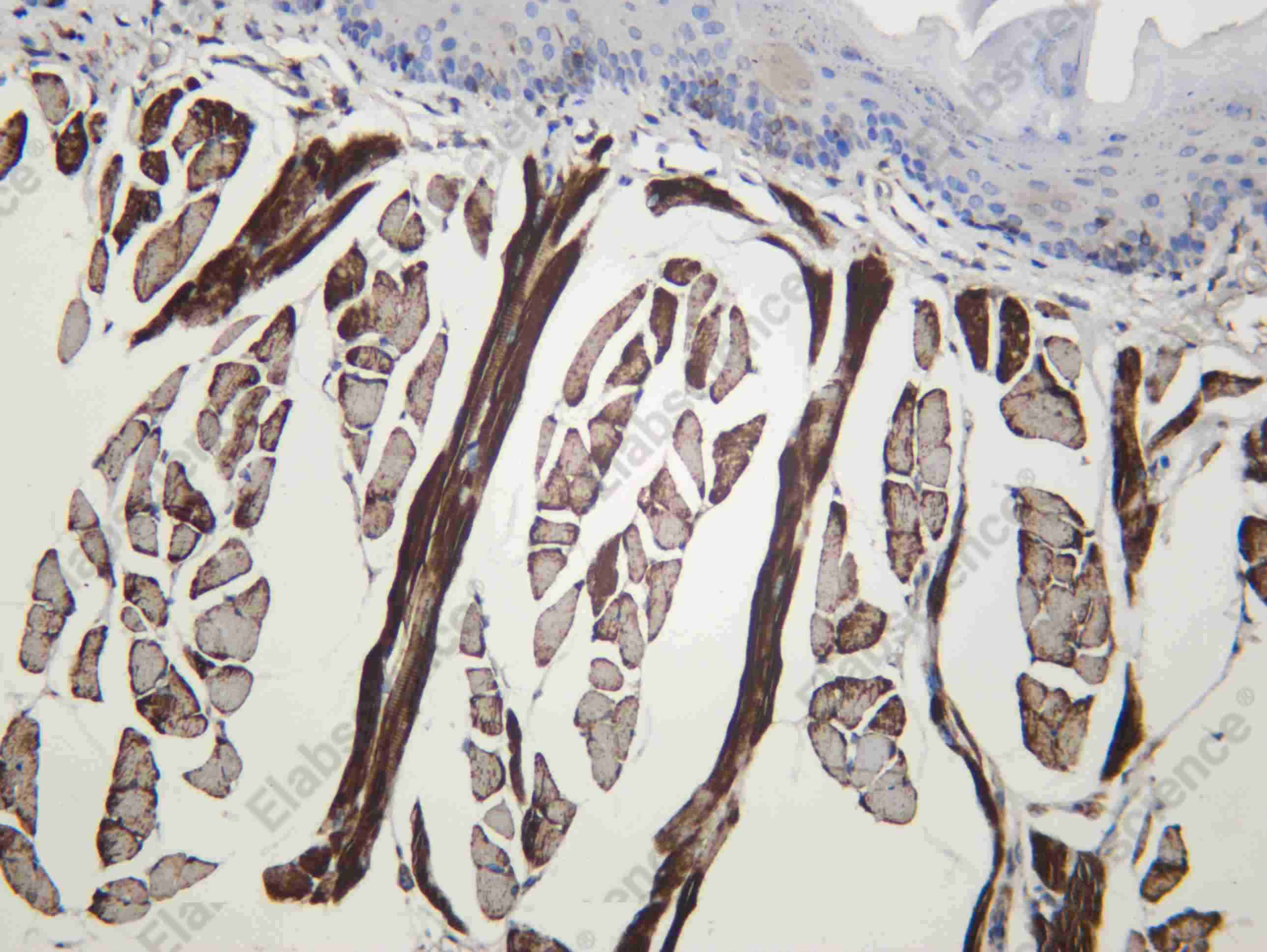Recombinant Amphiphysin II Monoclonal Antibody - 2
