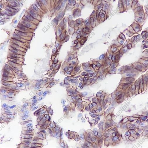 Recombinant Cadherin-17 Monoclonal Antibody - 1