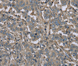 FBP1 Polyclonal Antibody - 2