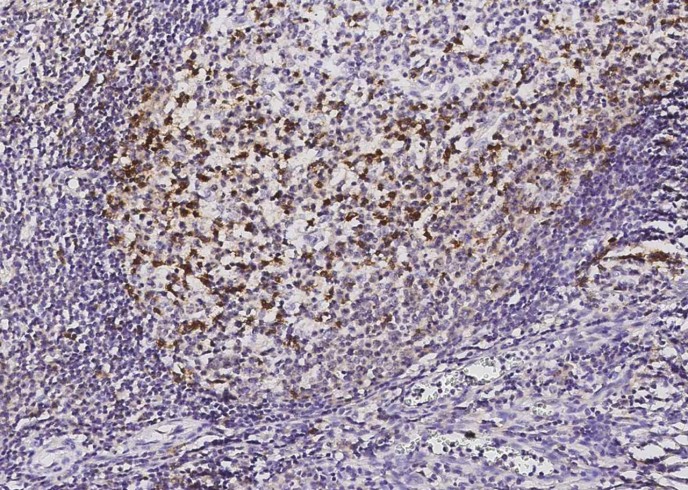 PD1/PDCD1/CD279 Monoclonal Antibody - small - 3