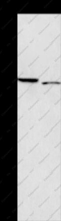 ICAM5 Polyclonal Antibody - 1