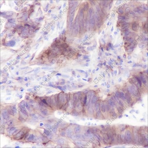 Recombinant hENT1 Monoclonal Antibody - 1