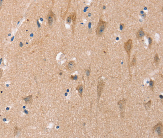 Immunohistochemistry of paraffin-embedded Human brain using OTUB1 Polyclonal Antibody at dilution of 1:40