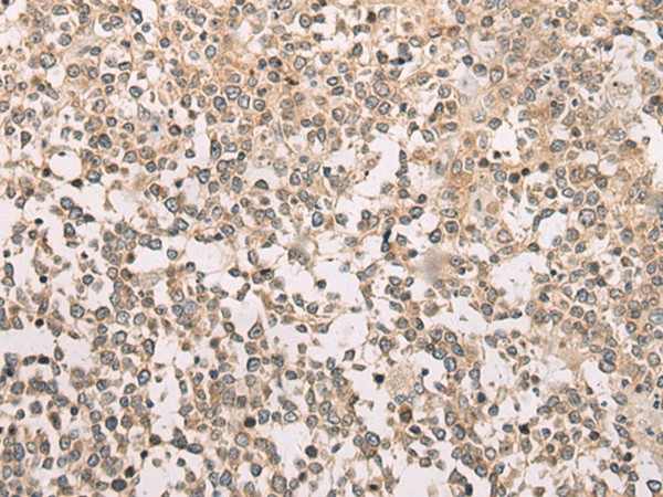 Immunohistochemistry of paraffin-embedded Human tonsil tissue  using M1AP Polyclonal Antibody at dilution of 1:80(?200)