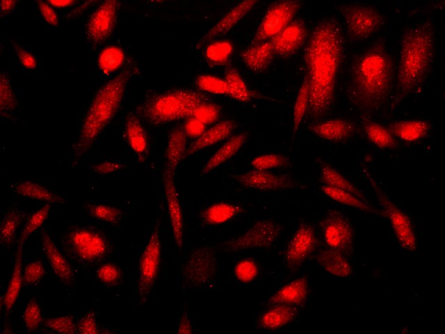 Immunofluorescence analysis of PC-3 cells using p16 Polyclonal Antibody at dilution of 1:100