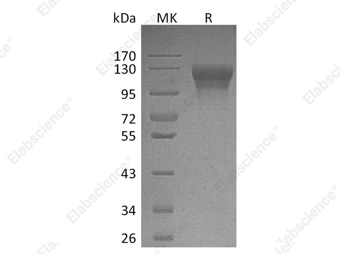 Recombinant Human LEPR/CD295 Protein (His Tag) - 1