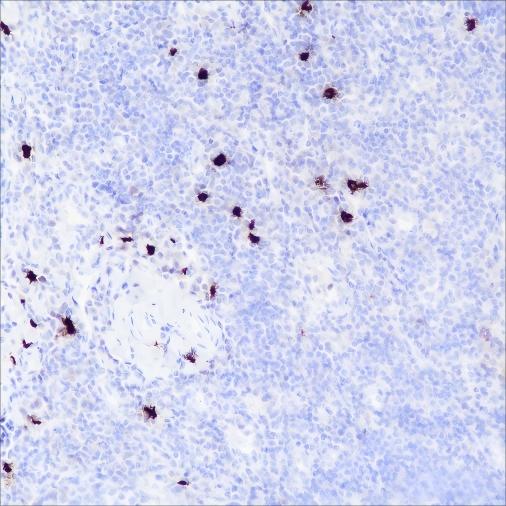 Recombinant TPSAB1 Monoclonal Antibody-searchlist-1