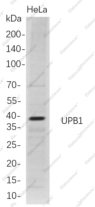 Recombinant UPB1 Monoclonal Antibody - 1